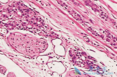 ǰ���ٰ�������������ֳϵͳ�����е�һ��