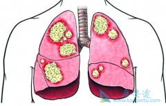 �зΰ�����е�ķΰ�������ô���ƣ�