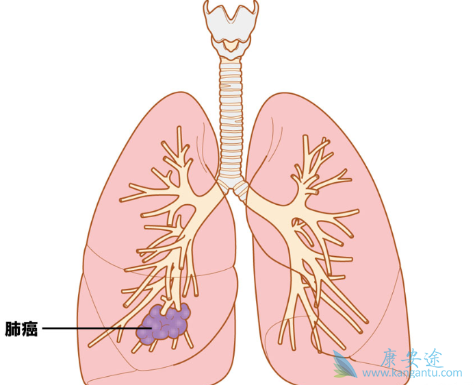 ��֢�����ܻ���;�ΰ����˳�ʲô