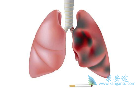 恶性肿瘤;癌症 恶性肿瘤;癌症