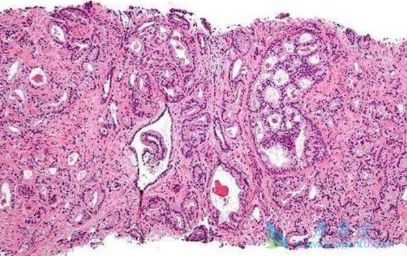 ����;ǰ���ٰ�