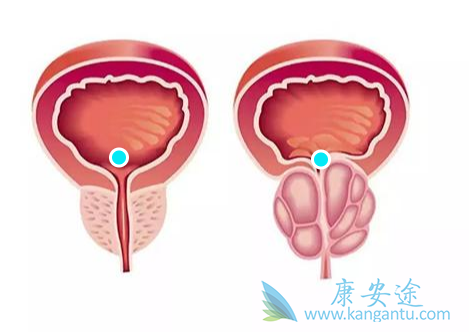 ǰ���ٰ�;��������