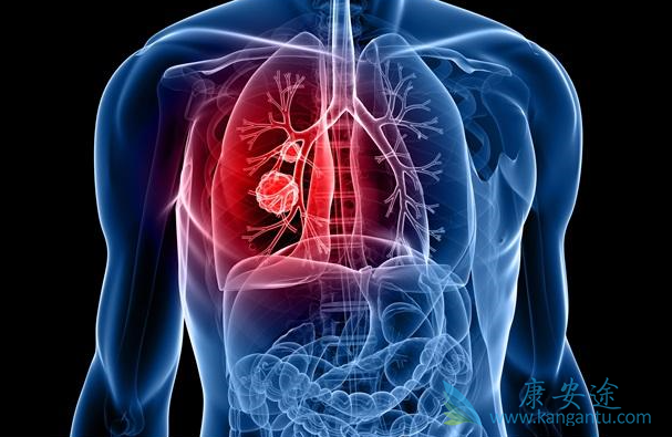 肺癌egfr靶点 肺癌egfr靶点