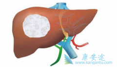 �ΰ����û���ҩ������Щ�����Ӱ���������ʲô�Ʒ���