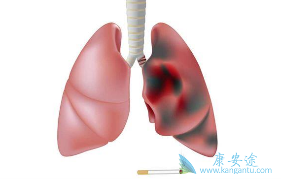 Сϸ���ΰ�;�ΰ�������