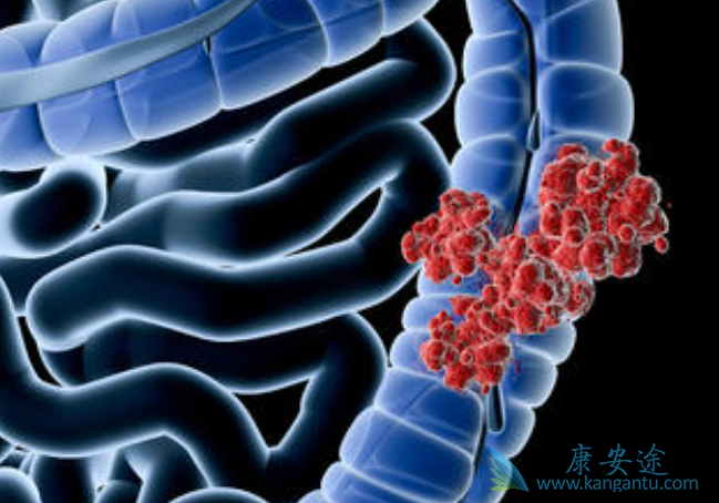 ��ֱ����