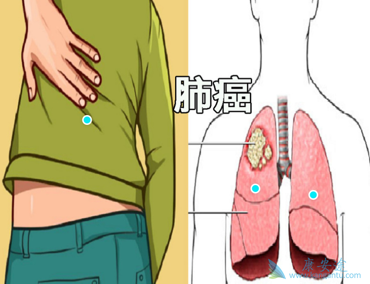 �ΰ����ڵ�֢״;�ΰ�������