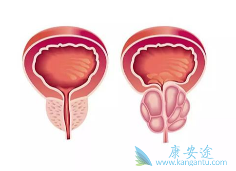 ǰ���ٰ�;��������