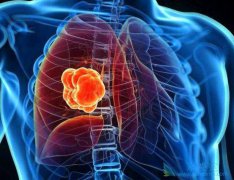 �ΰ����ڱ�������Щ�أ����зΰ�������