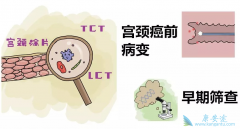 ���Ԥ��HPV�����������������������ʸ���