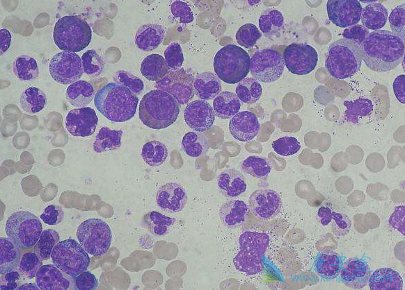 ������Ѫ��