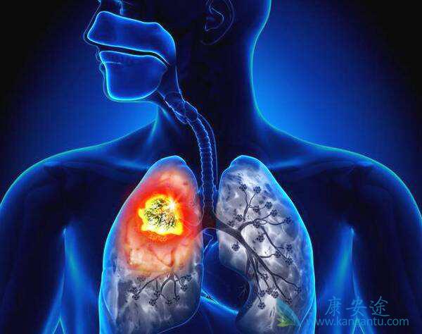 �ΰ���Ԥ��