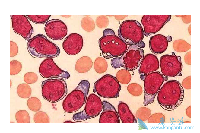 �����԰�Ѫ��