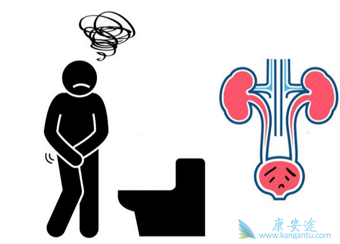 前列腺癌 前列腺癌