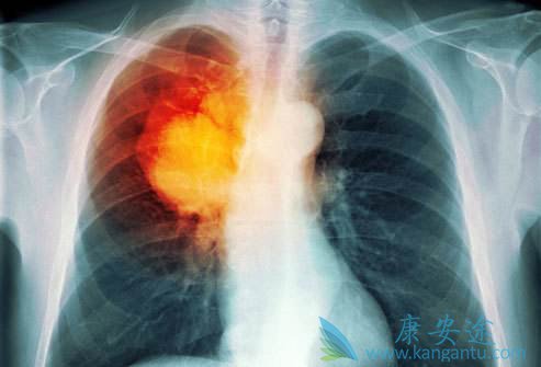 �ΰ������ܻ�����淶�ķΰ������й�