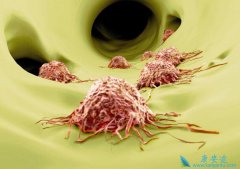 �ﻪһ��4�ڻ������ڣ���ëŮ���а���ϲ�� ע��Ԥ����֢