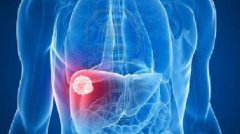 �ΰ���֢״��ʲô����ν��͸ΰ����գ�   