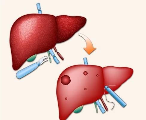 ���Ҹ���������Ҫ�ո���