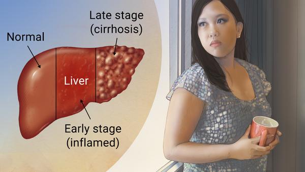 ��Ҫ���Ҹδ�����֢״����Щ