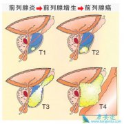 ������Ӿ������Ԥ��ǰ���ٰ�֢